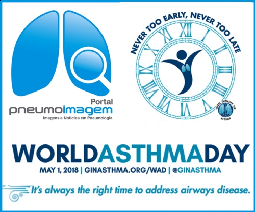 LAN�ADAS AS NOVAS DIRETRIZES DA GINA-2018 NO DIA MUNDIAL DA ASMA: FA�A O DOWNLOAD